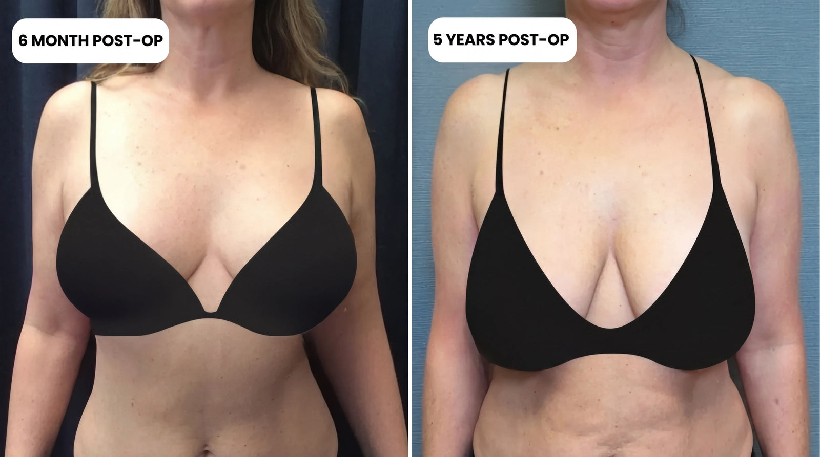 Editorial split lifestyle image showing confident versus subdued posture